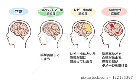 大腦插圖集 大腦插圖集 122155397