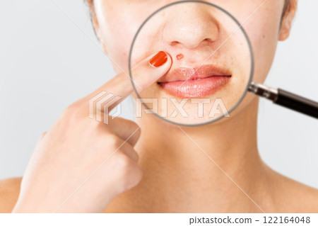 一名年輕女子臉上的一個痘痘被放大鏡放大。 一名年輕女子臉上的一個痘痘被放大鏡放大。 122164048