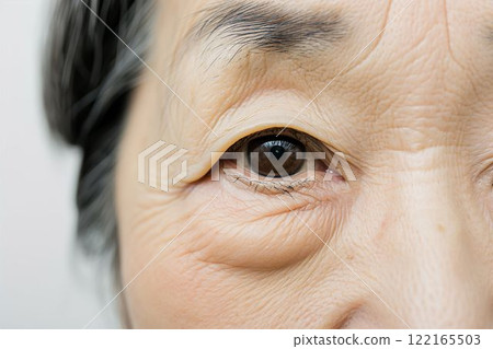 An elderly woman suffering from wrinkles, sagging skin, and age spots (ptosis, under-eye bags, cosmetic surgery, rejuvenation) 122165503