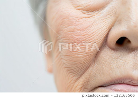 An elderly woman suffering from wrinkles, sagging skin, and age spots (ptosis, under-eye bags, cosmetic surgery, rejuvenation) 122165506