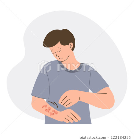 Man with itchy skin rash. Allergic itching, skin inflammation, redness and irritation. Healthcare and medicine. Man with itchy skin rash. Allergic itching, skin inflammation, redness and irritation. Healthcare and medicine. 122184235