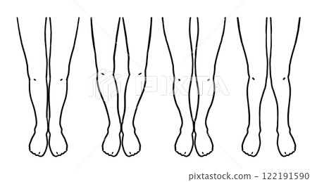 四種簡單腳型圖解 122191590