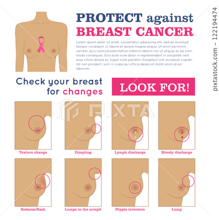 Protection breast cancer infographic Protection breast cancer infographic 122194474
