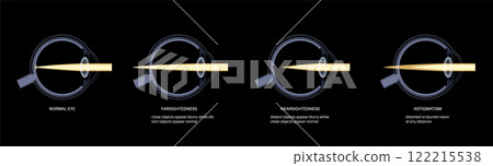 Refractive errors poster 122215538