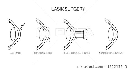 LASIK eye surgery 122215543