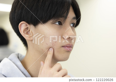 Male student concerned about rough skin 122220026