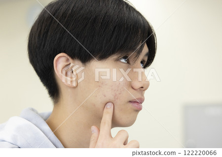 擔心皮膚粗糙的男學生 122220066