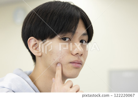 擔心皮膚粗糙的男學生 122220067
