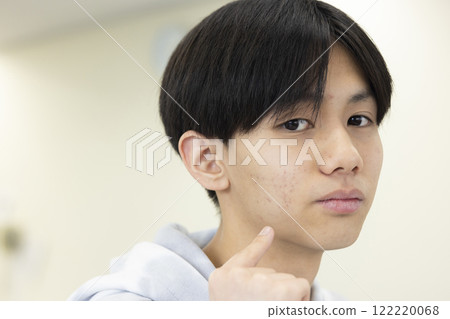 擔心皮膚粗糙的男學生 122220068