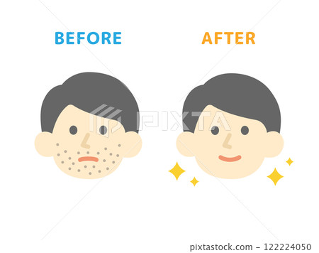 Beard hair removal, before and after icon illustration Beard hair removal, before and after icon illustration 122224050
