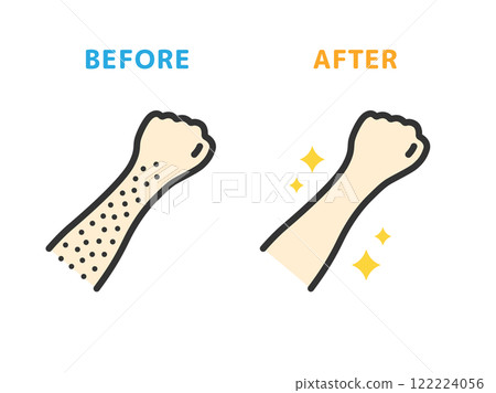 Arm hair removal, before and after icon (line drawing color) illustration Arm hair removal, before and after icon (line drawing color) illustration 122224056