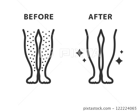 Illustration of before and after icon (line drawing) of leg hair removal Illustration of before and after icon (line drawing) of leg hair removal 122224065