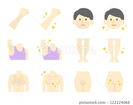 Illustration of before and after hair removal icons for various parts of the body 122224068