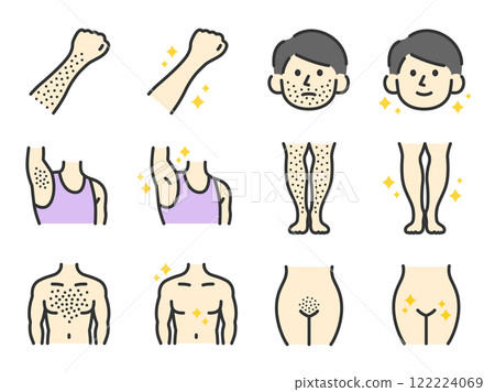Illustrations of before and after icons (line drawings color) of hair removal on various parts of the body Illustrations of before and after icons (line drawings color) of hair removal on various parts of the body 122224069