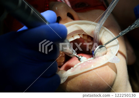 dental instruments Beautiful senior woman at dentist having dental treatment at dentist's office dental instruments Beautiful senior woman at dentist having dental treatment at dentist's office 122250130
