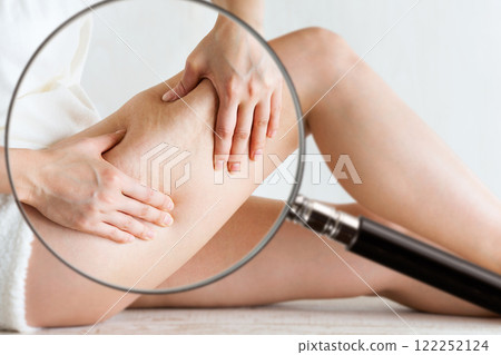 A magnifying glass is used to magnify cellulite on a woman's thighs. 122252124