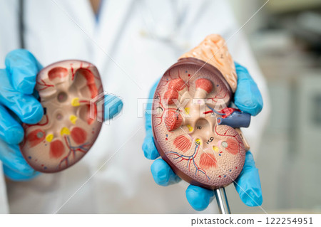 Chronic kidney disease, doctor with model for treatment urinary system, urology, Estimated glomerular filtration rate eGFR. 122254951