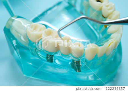 Teeth dental model with tool for dentist use to cleaning care treatment. Teeth dental model with tool for dentist use to cleaning care treatment. 122256857
