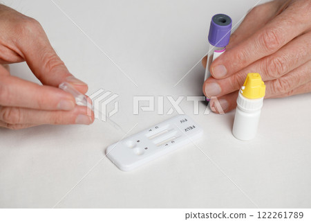 FIV and FeLV test kit. Male veterinarian practitioner doing medical sample rapid diagnostic test  122261789