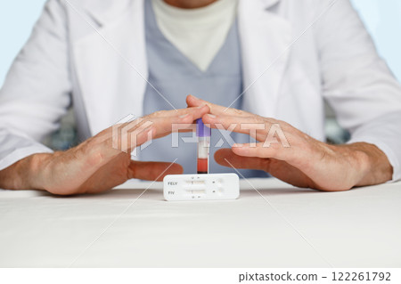 Vet with test tube with blood serum and rapid test for detection of FIV and FeLV in cats close up 122261792