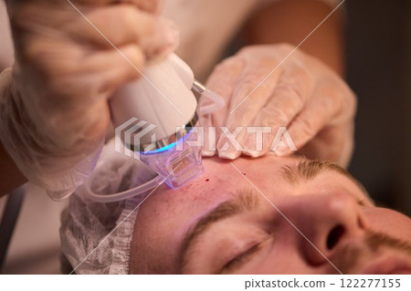A man is currently undergoing a specialized facial treatment within a serene spa setting 122277155