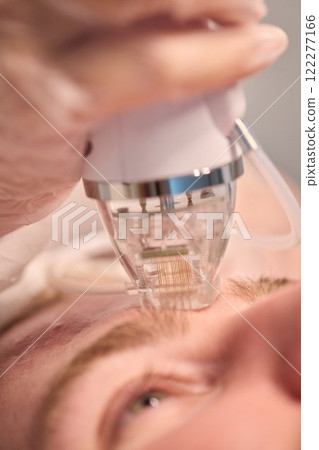 A man is currently undergoing a specialized facial treatment within a serene spa setting 122277166