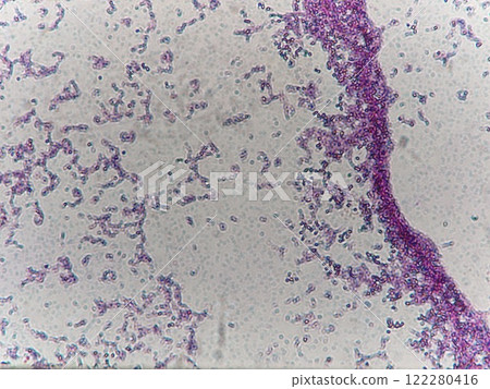 Gram stained lactic acid bacteria Gram stained lactic acid bacteria 122280416