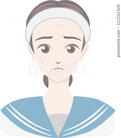 Junior and senior high school girls suffering from acne Junior and senior high school girls suffering from acne 122281926