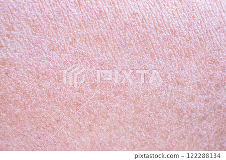 dry and dehydrated human skin texture background 122288134