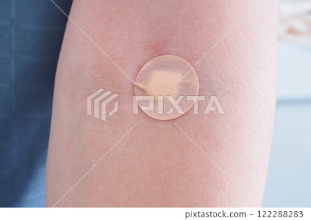 Round adhesive plaster on man arm close up 122288283