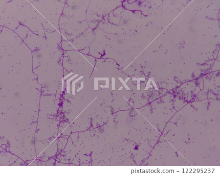A member of the Trichoderma family of imperfect fungi. A member of the Trichoderma family of imperfect fungi. 122295237