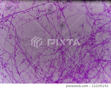 Black mold growing on condensation in the refrigerator glass Black mold growing on condensation in the refrigerator glass 122295242