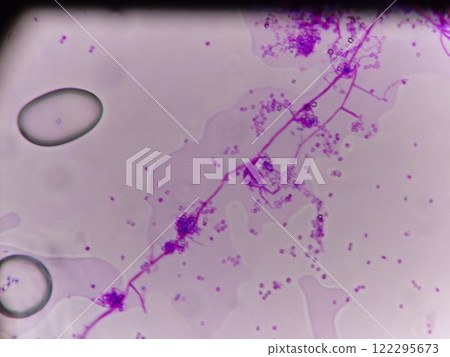 Straight hyphae Straight hyphae 122295673