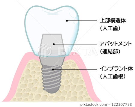 注入 注入 122307758