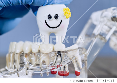 Playful Dental Implant Model Featuring a Smiling Tooth Character with a Gloved Hand Demonstration 122317051