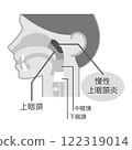 慢性鼻咽炎解釋圖，黑白，圖解_圖解 122319014