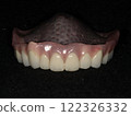 Denture 122326332