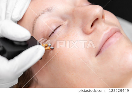 Close-up beautician doctor hand making anti-age face remodel procedure treatment with hardware microcurrent electric tool attractive young 30-40 female model at beauty clinic. Cosmetologist skincare 122329449