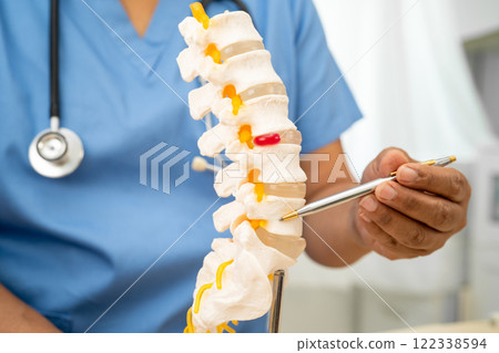 Doctor with lumbar vertebra bone skeleton and nerve model for treatment in the orthopedic department. 122338594
