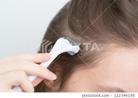 Close up of young woman using microneedling derma roller on head for stimulating new hair growth, copy space. Alopecia treatment, scalp stimulation, hair loss and baldness targeted therapy. Close up of young woman using microneedling derma roller on head for stimulating new hair growth, copy space. Alopecia treatment, scalp stimulation, hair loss and baldness targeted therapy. 122346198