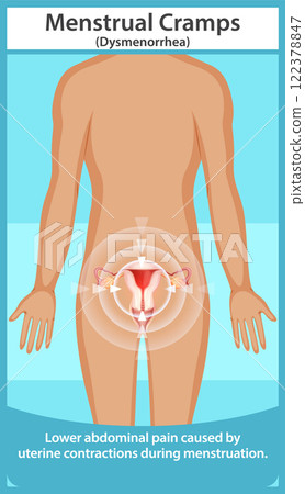 Understanding Menstrual Cramps and Dysmenorrhea Understanding Menstrual Cramps and Dysmenorrhea 122378847
