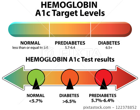 Hemoglobin A1c Levels and Diabetes Risk 122378852