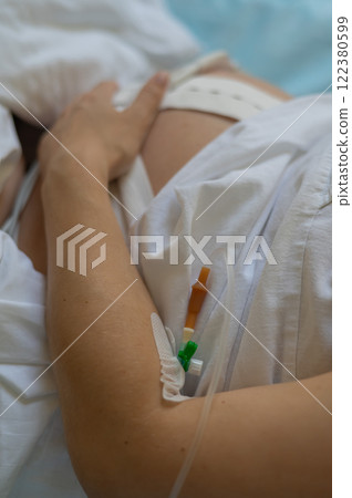 Close up of pregnant woman belly with cardiotocography sensor and IV in vein in delivery room.  122380599