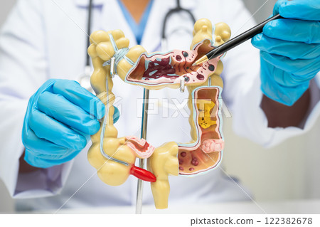 Intestine, doctor holding human anatomy model for study diagnosis and treatment in hospital. 122382678