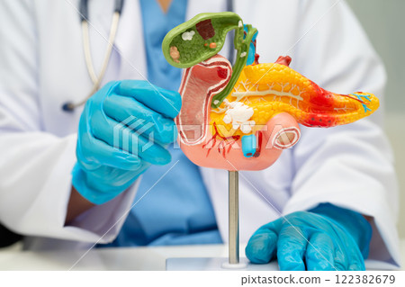 Pancreatitis, pancreatic cancer, Asian doctor with pancreas, gallbladder and bile duct human anatomy model at hospital. Pancreatitis, pancreatic cancer, Asian doctor with pancreas, gallbladder and bile duct human anatomy model at hospital. 122382679