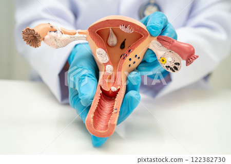 Uterus, doctor holding human anatomy model for study diagnosis and treatment in hospital. Uterus, doctor holding human anatomy model for study diagnosis and treatment in hospital. 122382730