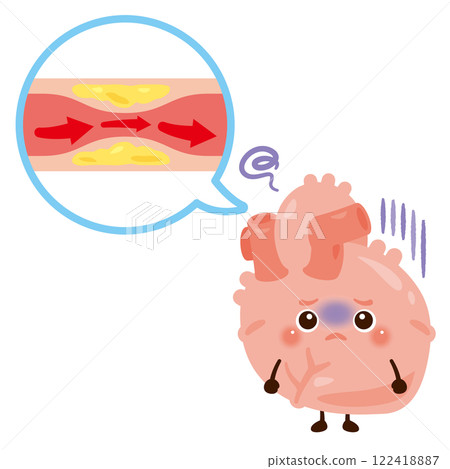 心絞痛心臟性格 122418887