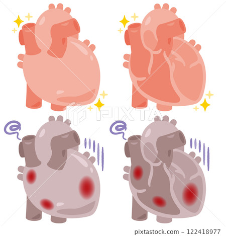 Illustration of a healthy and beautiful heart and an unhealthy heart with inflammation 122418977