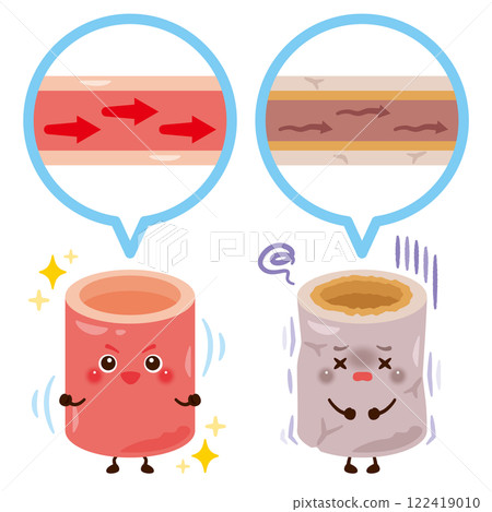 Character illustration of soft and healthy blood vessels and hard and unhealthy blood vessels 122419010