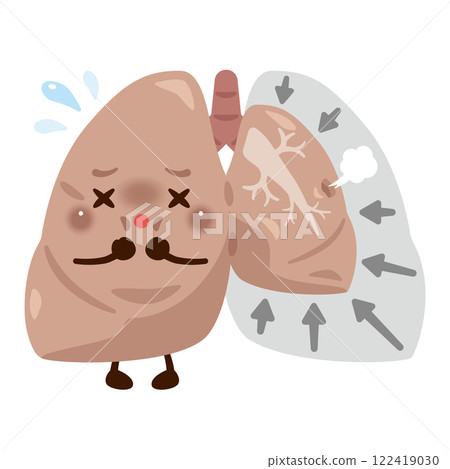 Collapsed lung character with pneumothorax Collapsed lung character with pneumothorax 122419030